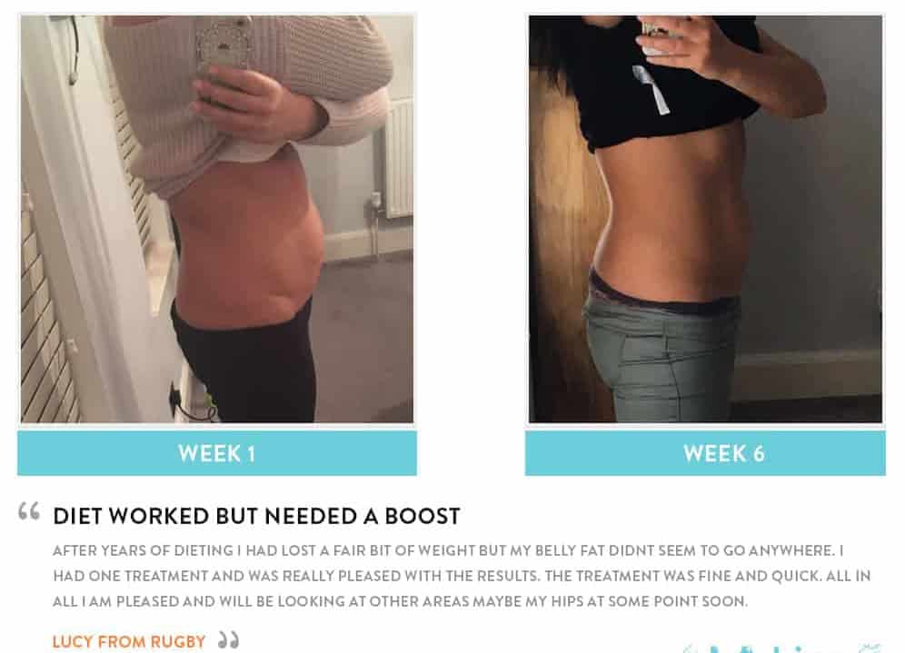 Before and After Dieting Barrow