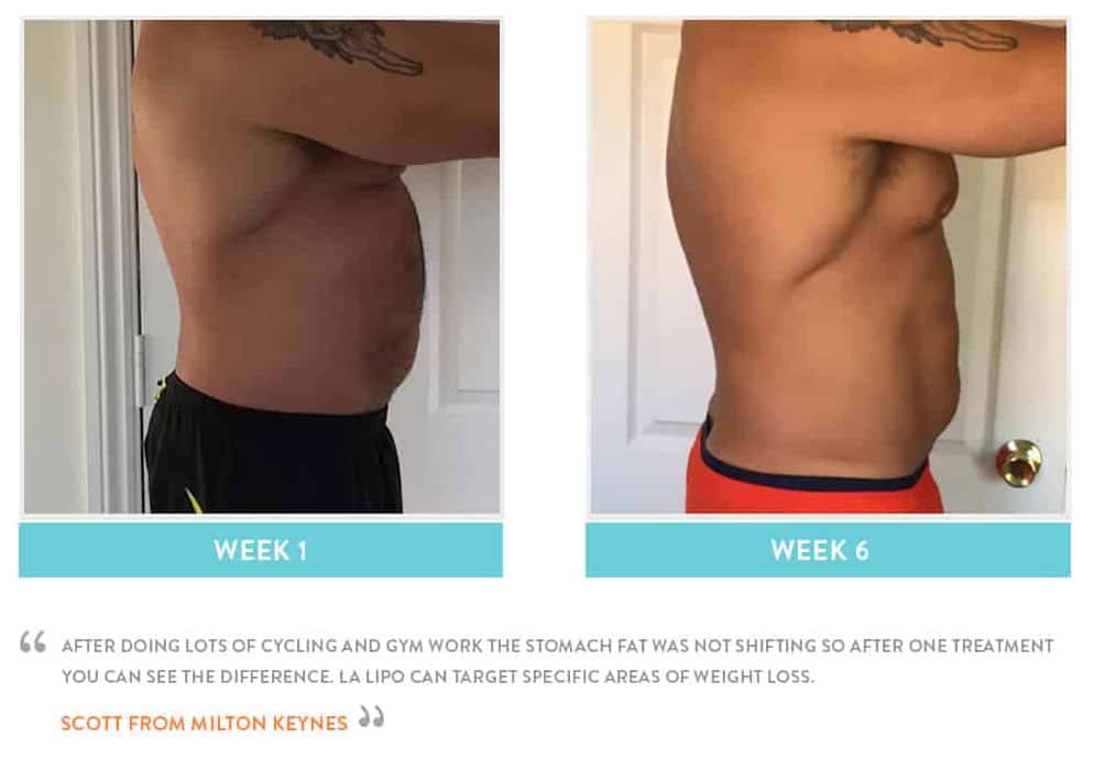 Before & After Stomach Fat Barrow