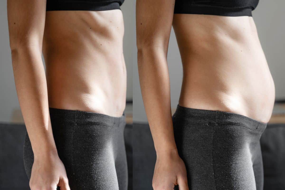 How long does diastasis recti take to improve Barrow?