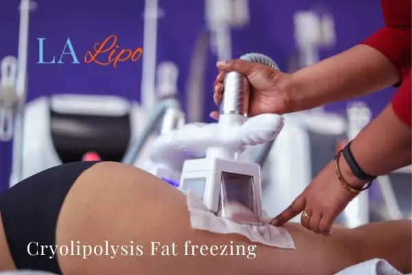women getting fat freezing Barrow