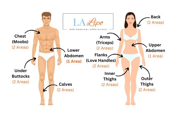 LA LIPO Cryolipolysis Areas Barrow
