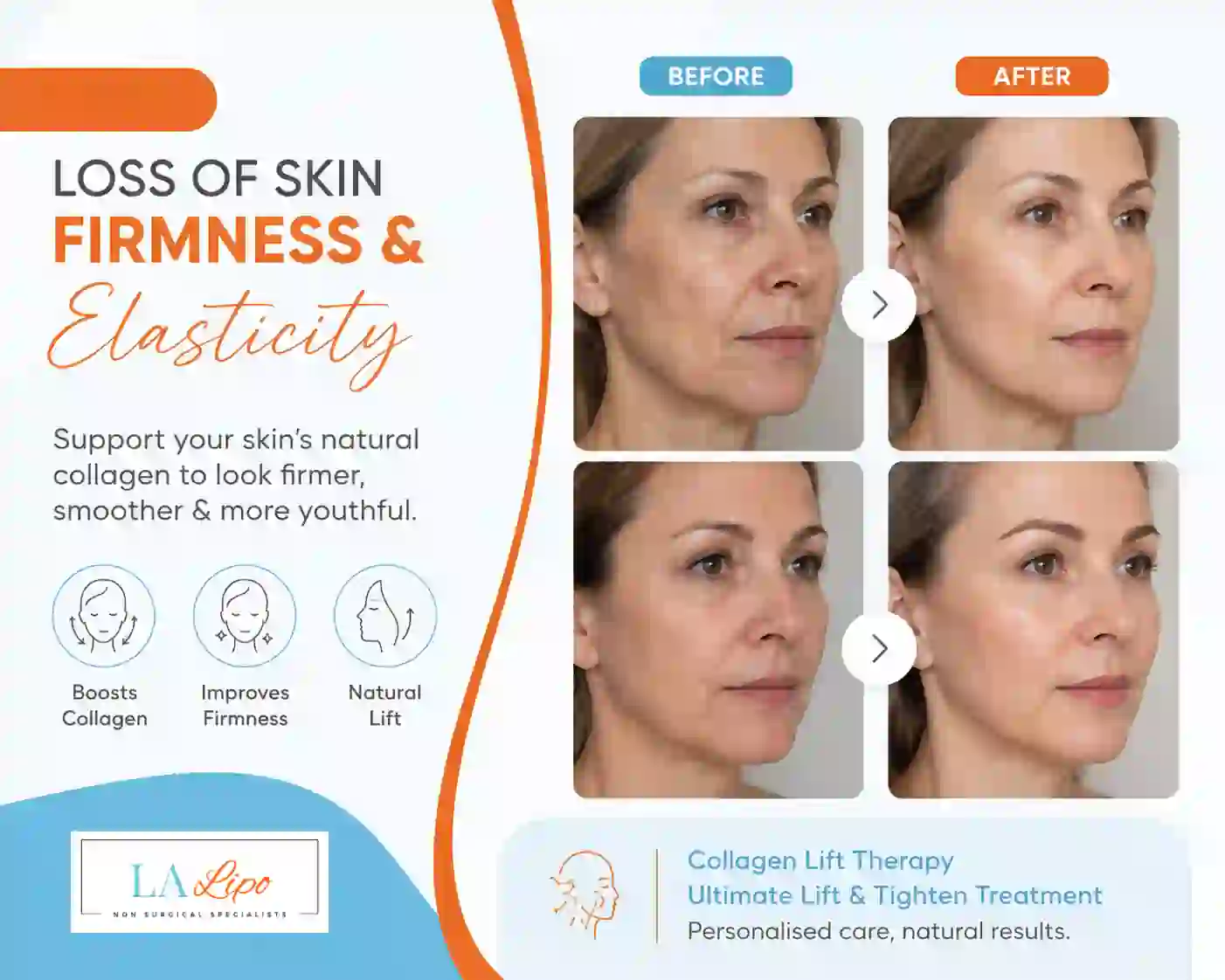 Sign #7: Loss of Skin Firmness and Elasticity Barrow